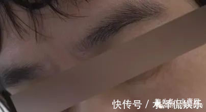 视网膜|危险!五旬阿姨一个喷嚏,差点失明…这些人都是高危!