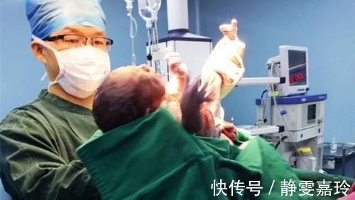 助产士|男医生充当了“接生婆”的角色，产妇的隐私怎么办？宝妈先别慌