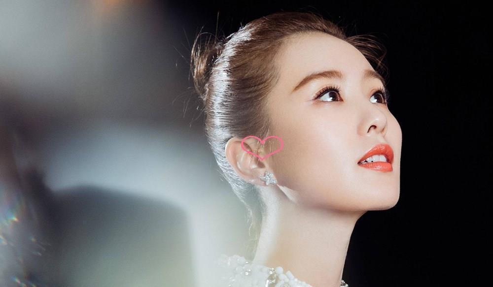 拴马桩|耳边多“肉揪”,孩子理发被嘲笑,耳有“拴马桩”是福气的象征?