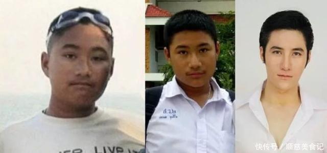 吸脂|泰国网红抽脂整出8块腹肌!告诉你抽脂多危险!带你科学练腹肌