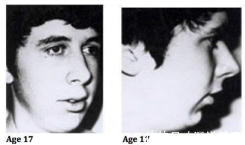 治疗|孩子睡觉总是张口呼吸，难道睡得香？告知家长，或许是这种病引起