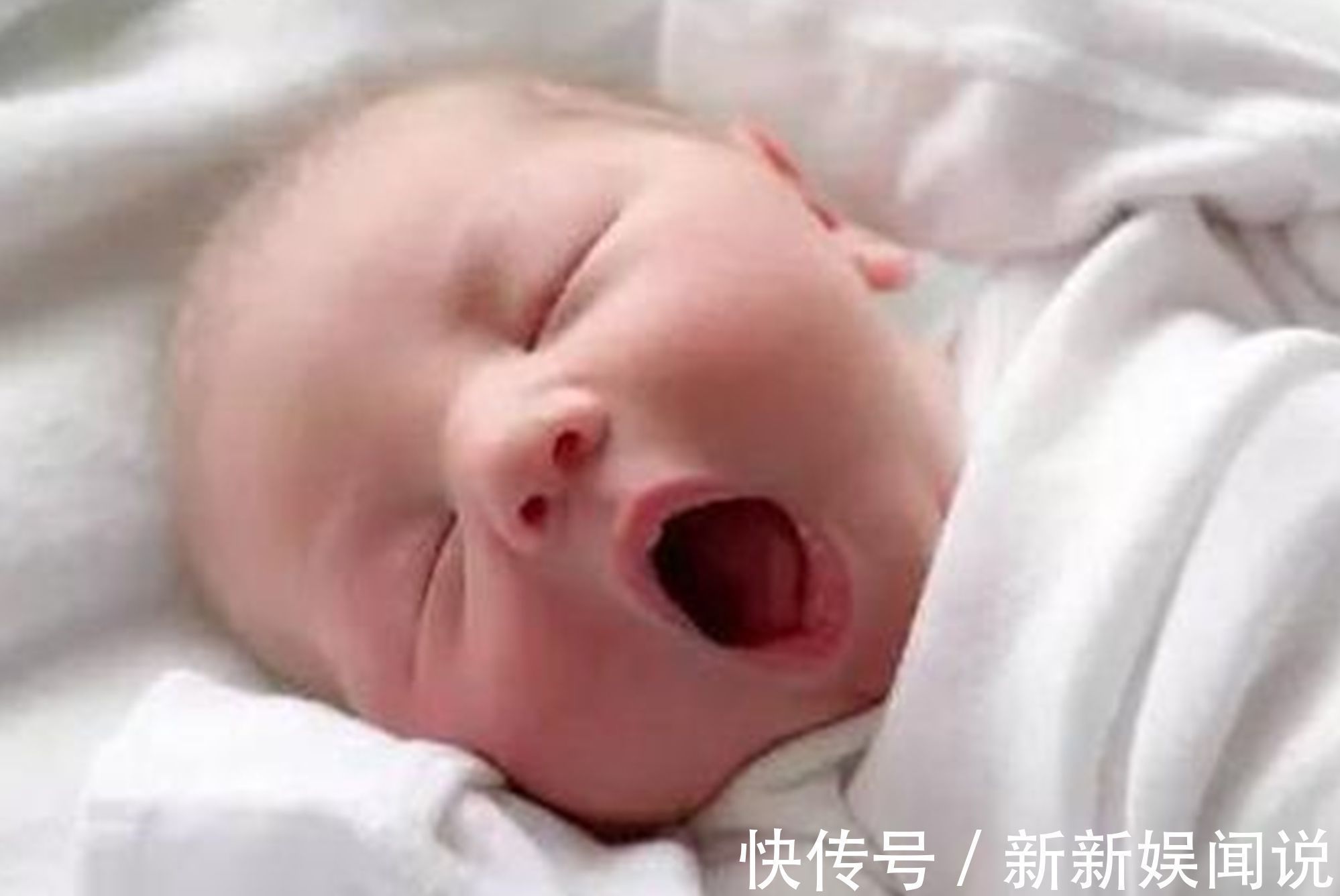 维娘胎里“整容”是什么体验?医生:孕期注意,你的孩子也不会丑