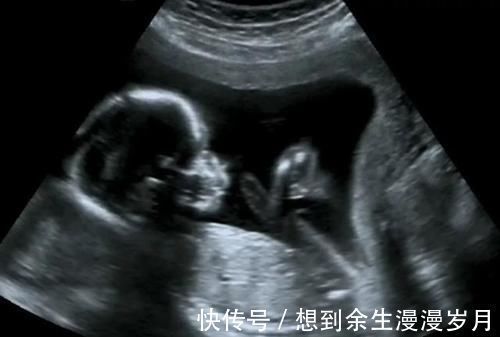 面部|做四维医生说腹部脂肪厚,看不清,打出来单子也只能看宝宝大概面部怎么办?