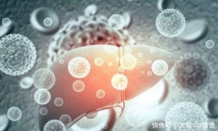 小陈|26岁少女查出肝癌,医生解释:1个习惯害的