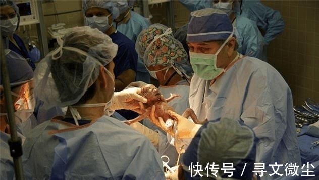 6胞胎|女子怀6胞胎进产房，不到3分钟生完，医生和护士看傻眼了！