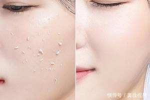 面膜|敷面膜的五大误区,你知道吗?