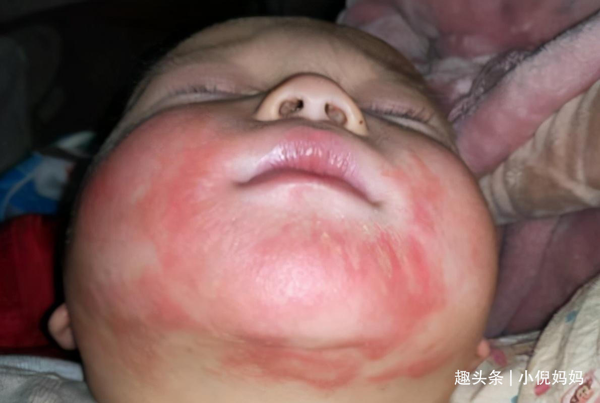 鸡蛋羹|儿科医生建议最好别给宝宝吃鸡蛋羹,还在喂的家长,需要注意