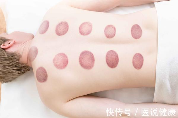 日常饮食|体内湿气过重,会影响身体这3个部位,若你有,要及时进行调理