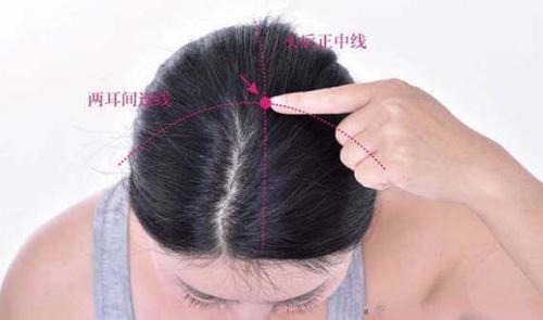  百会穴|开启人体阳气的“金钥匙”，要经常拍一拍，阳气不断涌出来