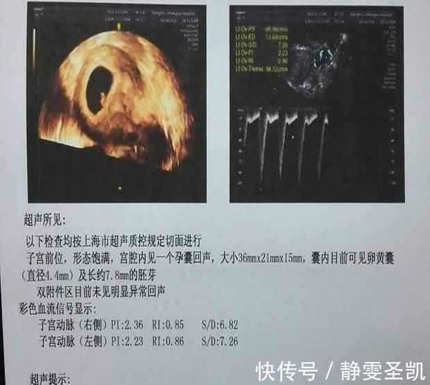 胚层|胎心胎芽出现的时间,为何有早有晚?这3个原因很说明问题