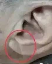 人体|看人体的这3处，就知道心脏好不好！3大简单养心法，一起学起来