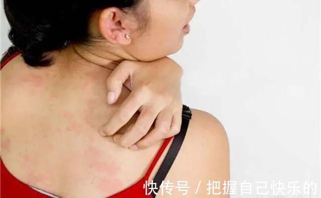 肝脏|肝不好的人,睡觉时会有“1痒,2痛,3多”,若没有,肝脏还不错