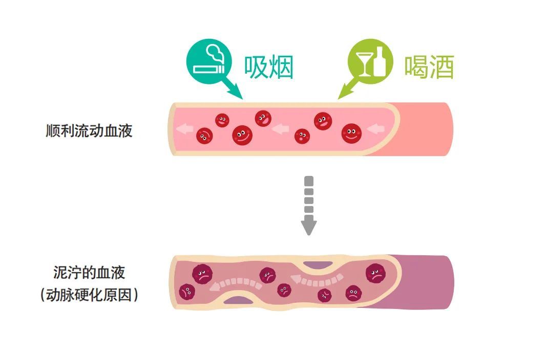 戒烟|吸烟、饮酒伤血管，年轻人也无法幸免！保护血管，最好滴酒不沾，越早戒烟越好！