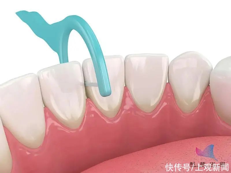 牙结石|警惕！这样刷牙不仅刷不干净，还毁牙！大多数人都做错了