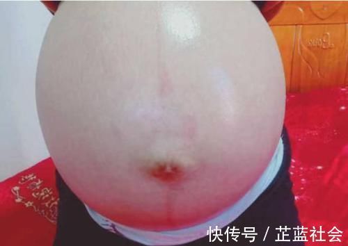 宝宝|孕妈一般在什么时候开始“显怀”？若显怀过早，可能是这几个原因