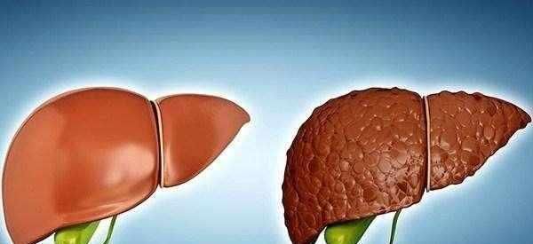 绿色食物|出现三种信号,可能是肝硬化上门,四种食物尽量戒掉吧,很伤肝!