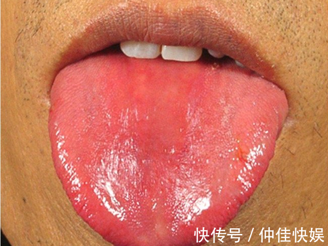 体质|舌是脏腑“本色反映”,8种体质,8种舌象,老中医教你怎么望舌