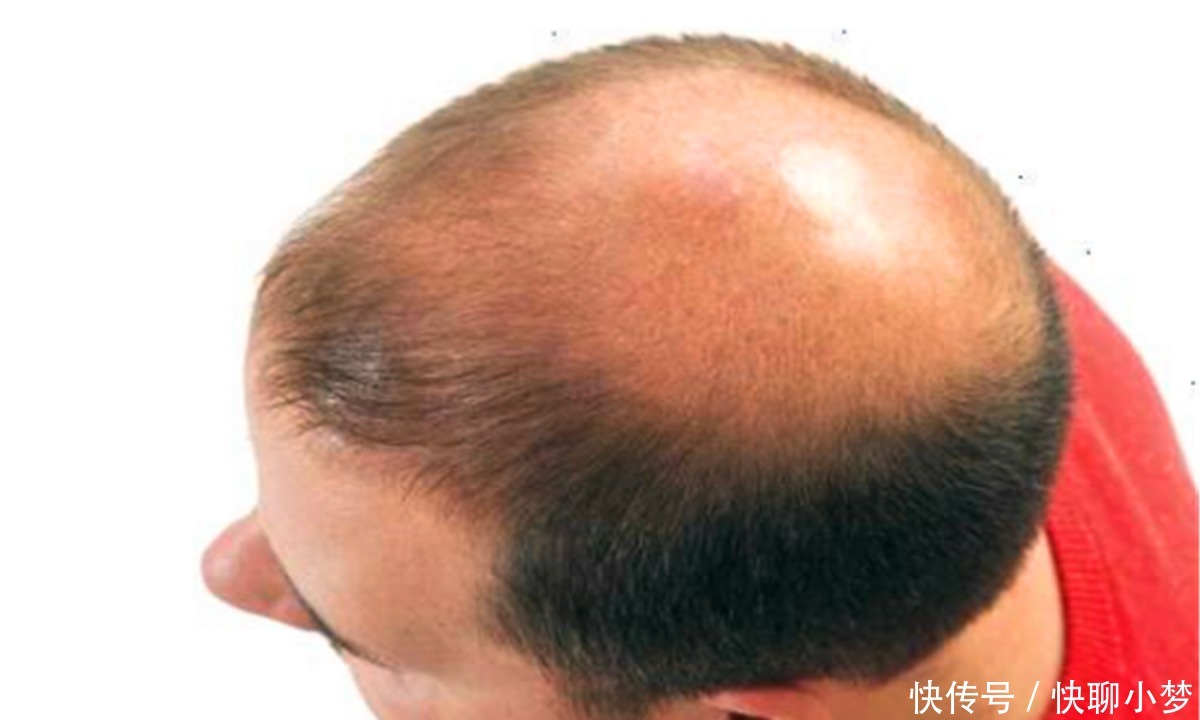 哪种|识人俗语:“穷人脚上无毛,富人头顶放光”,啥意思?你是哪种人