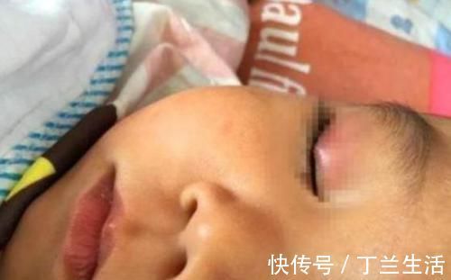 宝妈|4岁孩子误把502滴入眼睛,宝妈60秒反应救了孩子,医生:很高明