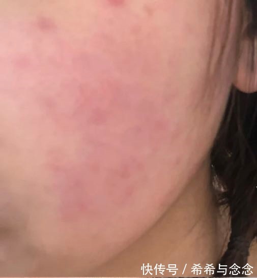 孕妇|从不做广告的小众护肤品,深受孕妇喜爱!效果不输大牌,还超安全