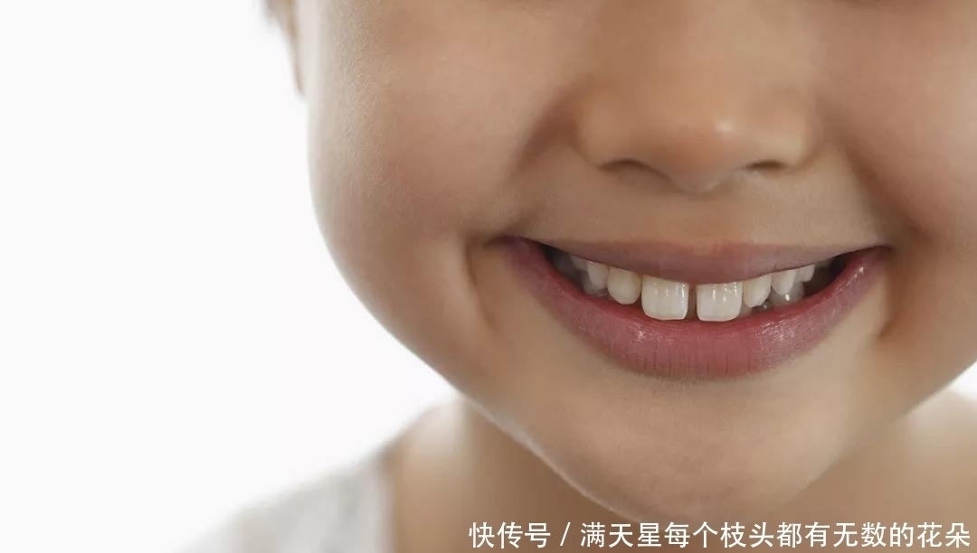 牙齿|掉牙也分先后!若换牙顺序和年龄对不上,多半出现了健康问题