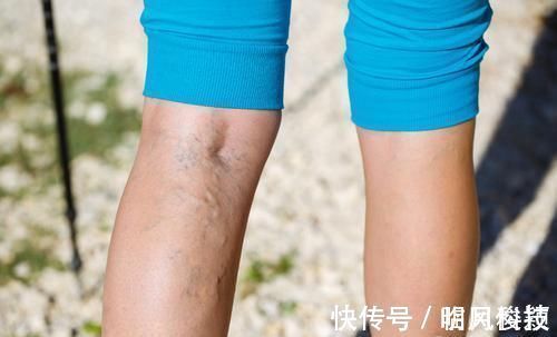 养生|晚上泡脚，是养生还是“慢性自杀”？医生：5种人泡脚百害无一利