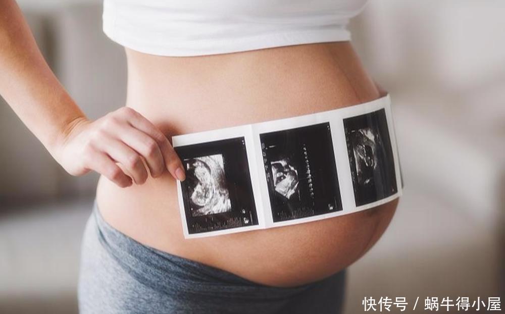 胎儿|女性怀孕后,睡觉时的这个行为,对胎儿发育影响很大,孕妈别大意