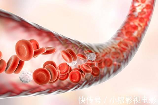 高密度胆固醇|被查出高胆固醇,不想吃药怎么办?分享4点建议,血脂或许会下降