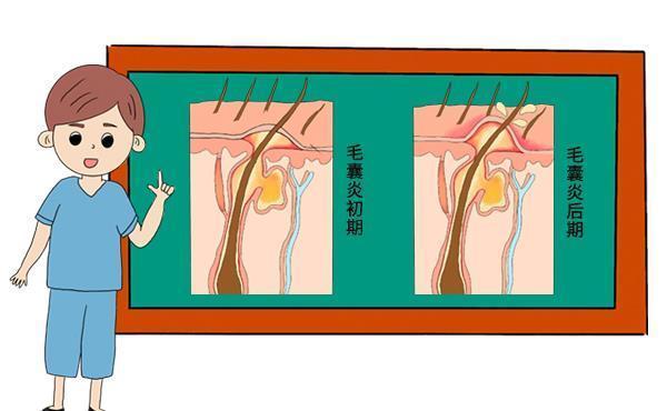 糖尿病患者|头皮上经常长小疙瘩,一碰就疼,对身体有什么影响吗?告诉你答案