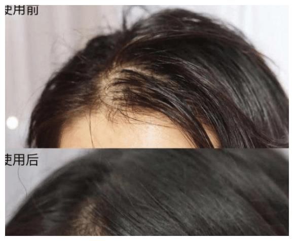 为什么当代年轻人纷纷“嫌弃”超市大牌洗发水，反倒更爱新国货？