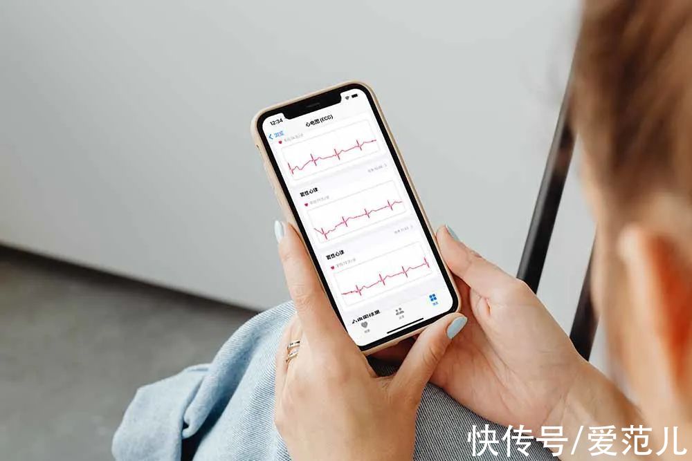 心电图|等了 3 年，国行版 Apple Watch 心电图功能终于来了