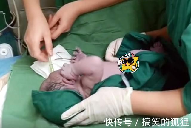 母乳|新生儿出生后,被护士抱走的10分钟经历了啥?这些处置一步不能少