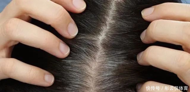 肝病都是拖出来的，一旦晨起有4个表现，是肝在“求救”，别大意