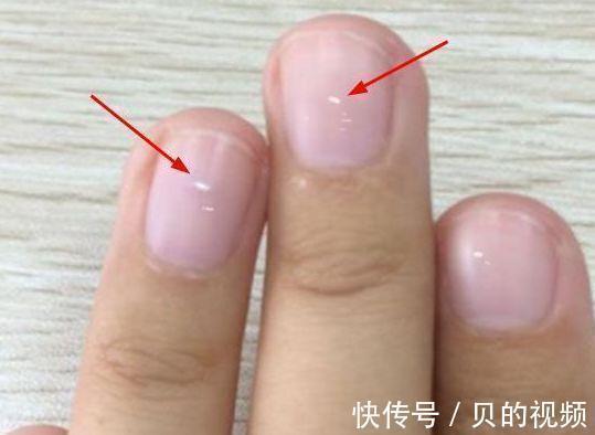 碳酸饮料|长个的“抑制剂”公布了,鲜奶也是之一吗?儿科医生:少给娃食