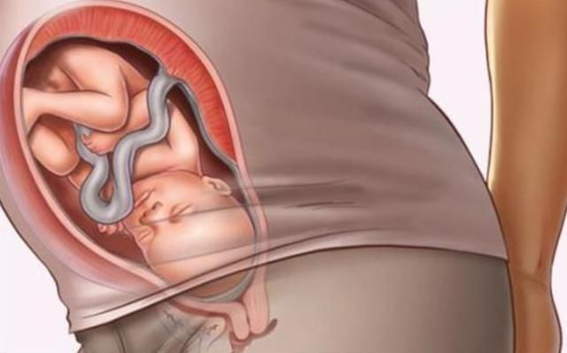 孕期综合症|孕期做到“4不碰”,有利于保持羊水“清澈”,胎儿住着更干净