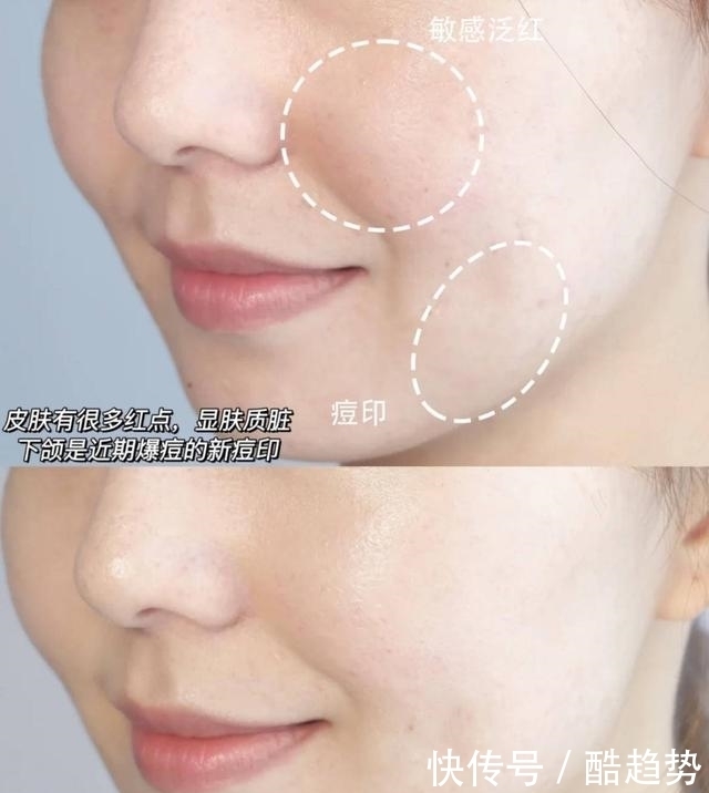 面部ps?有了它,痘印花脸都救活了,保湿度更无可挑剔