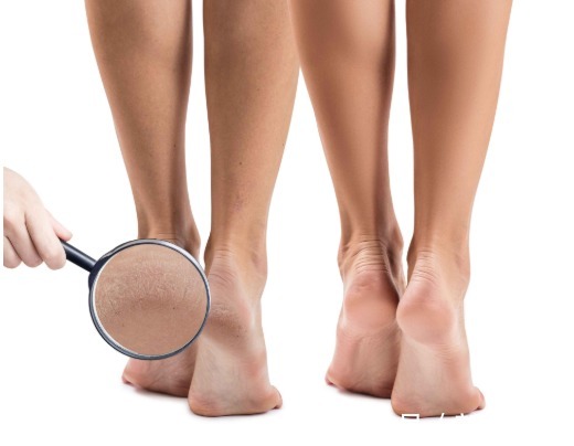 肝脏|肝硬化离肝癌只有一步,脚上一旦出现4种东西,是肝在求救