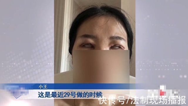 唐女士|“老公骂我是怪物，要跟我离婚!”重庆女子三次割双眼皮却越割越丑，整容变“毁容”?女子:想死的心都有了