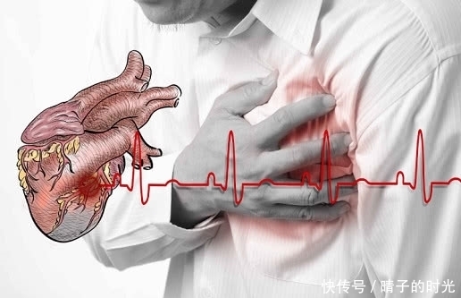 信号|心肌梗塞的5大危险信号,万万不可忽视,忽视一个可能都会送命!