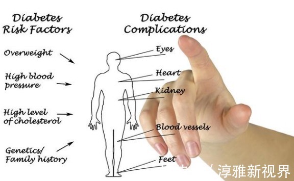 糖尿病人|糖尿病下肢消瘦如何改善除了控制好血糖,这两点值得重点关注