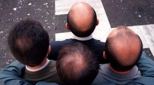 信号|男人开始衰老时，身体会发出4个信号，不妨自测下看自己占了几个