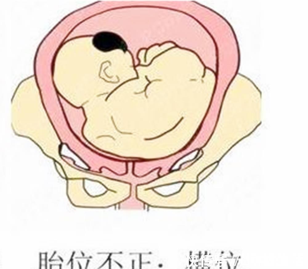 产妇|怀孕后多久,胎位就要固定了?这个孕周前,孕妈还能“调乾坤”