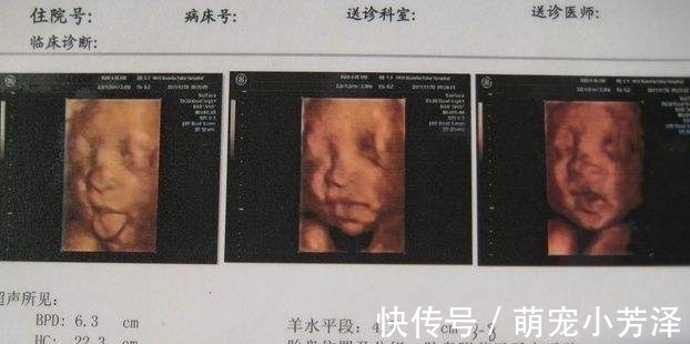 胎宝|22周四维彩超第一次见胎宝,被丑哭,这些原因导致胎儿看起来丑
