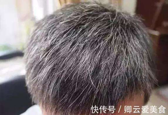 補虛|治白發最好的方子，可緩解白發太多的問題，補虛又烏發，值得體會