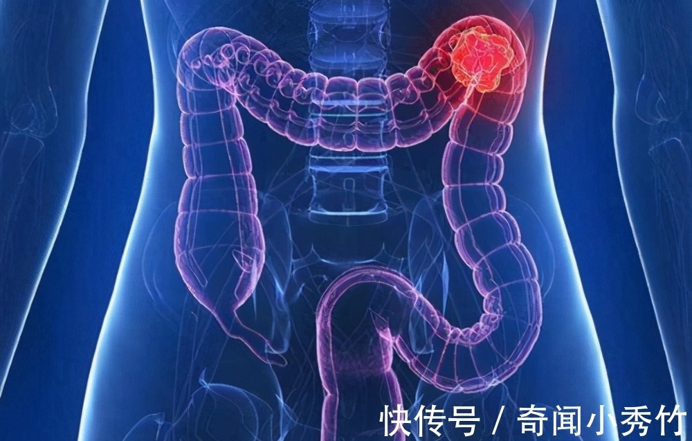 现实世界|21条奇趣冷知识,或许从未听说过,但却是真实存在于现实世界