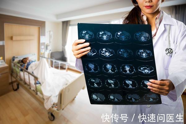 防癌筛查|人人都有患癌的可能性,但并非人人都会患癌,4类人是赢家