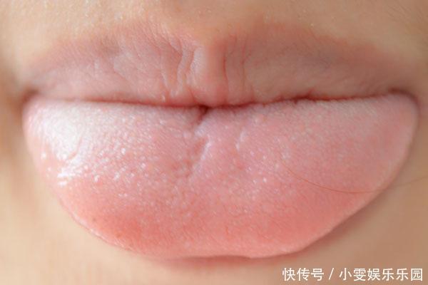 虚症|脾虚人就废了一半?脾虚的人记好健脾要诀,照样活得自在