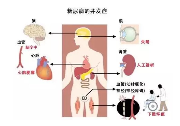 2型糖尿病|得了2型糖尿病会影响寿命吗？糖尿病患者如何长寿？