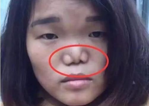 眼镜|初中女生别嫌鼻子不好看,3招变成好看“艺术鼻”,校花嫉妒使我丑陋
