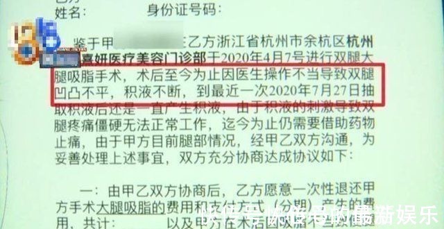 整形医院 女子做大腿吸脂手术,术后腿部有积液,跑了40多趟抽积液